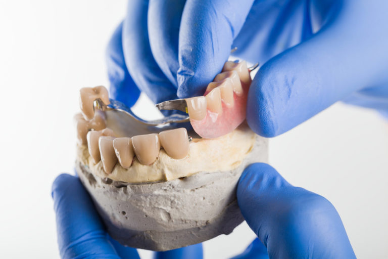 Dentures Partials Repairs Smile White Dental